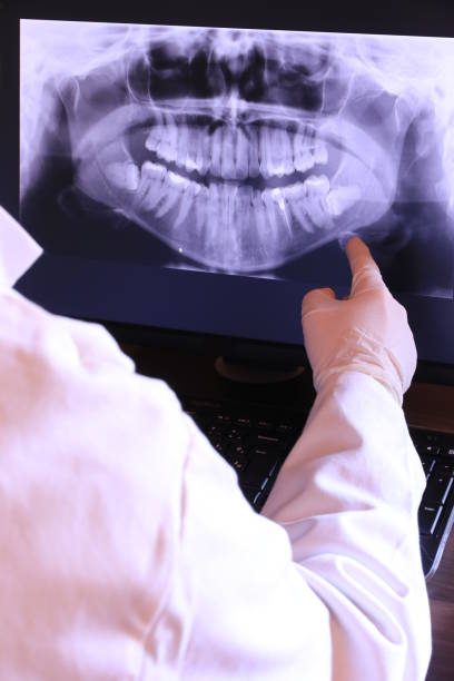 Best Emergency Wisdom Teeth Removal in Oakdale, CA
